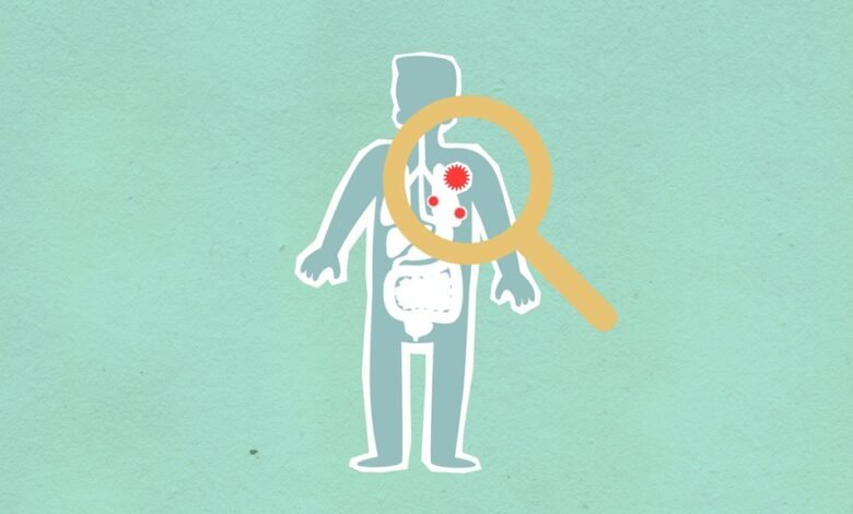 why how kialodenzydaisis kills